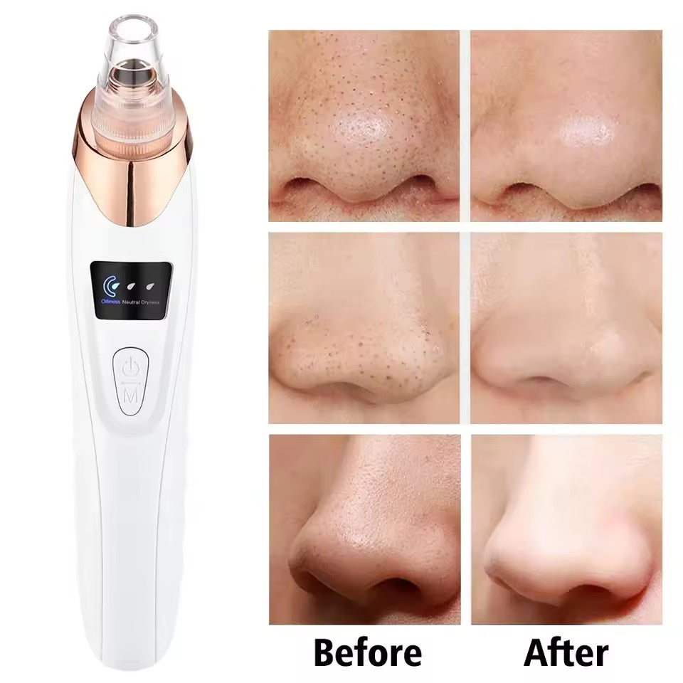 Facial Beauty - 5 in 1 Blackheads Vaccum Derma Suction