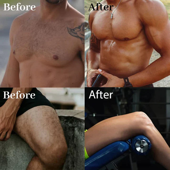 Ecrin Hair Removal Spray For Men & Women - 150ml