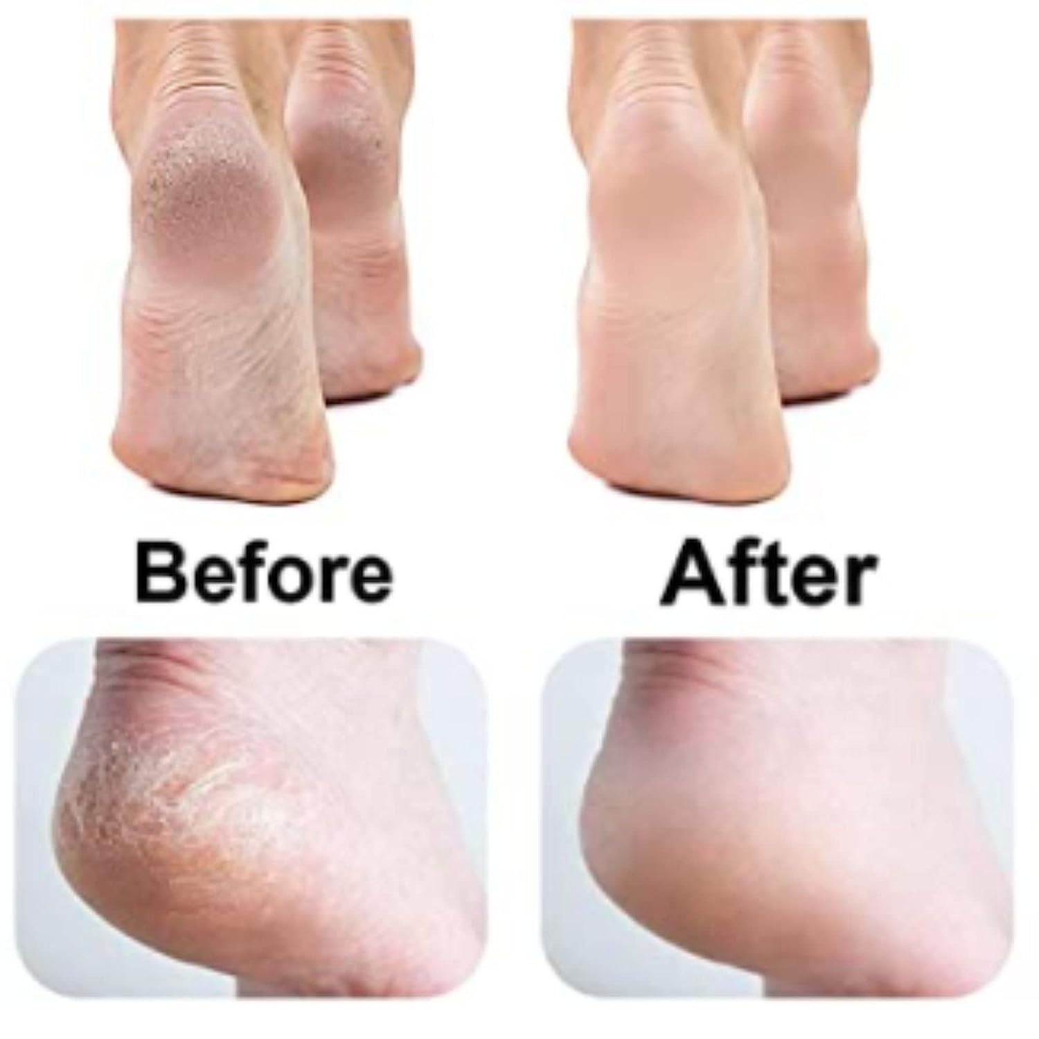 Dead Skin Removal Electronic Foot Filer l