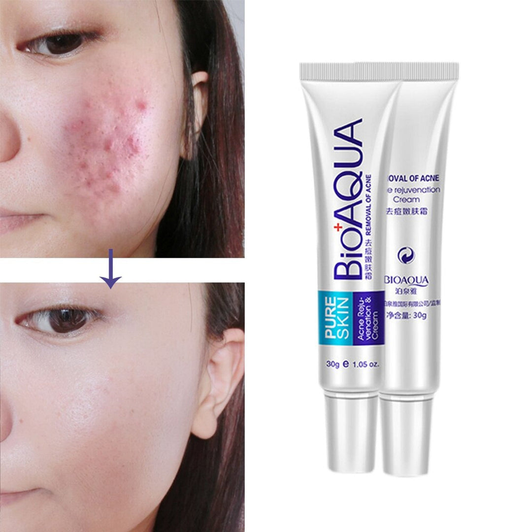 Bioaqua - Anti Acne Scar Removal Cream 30g