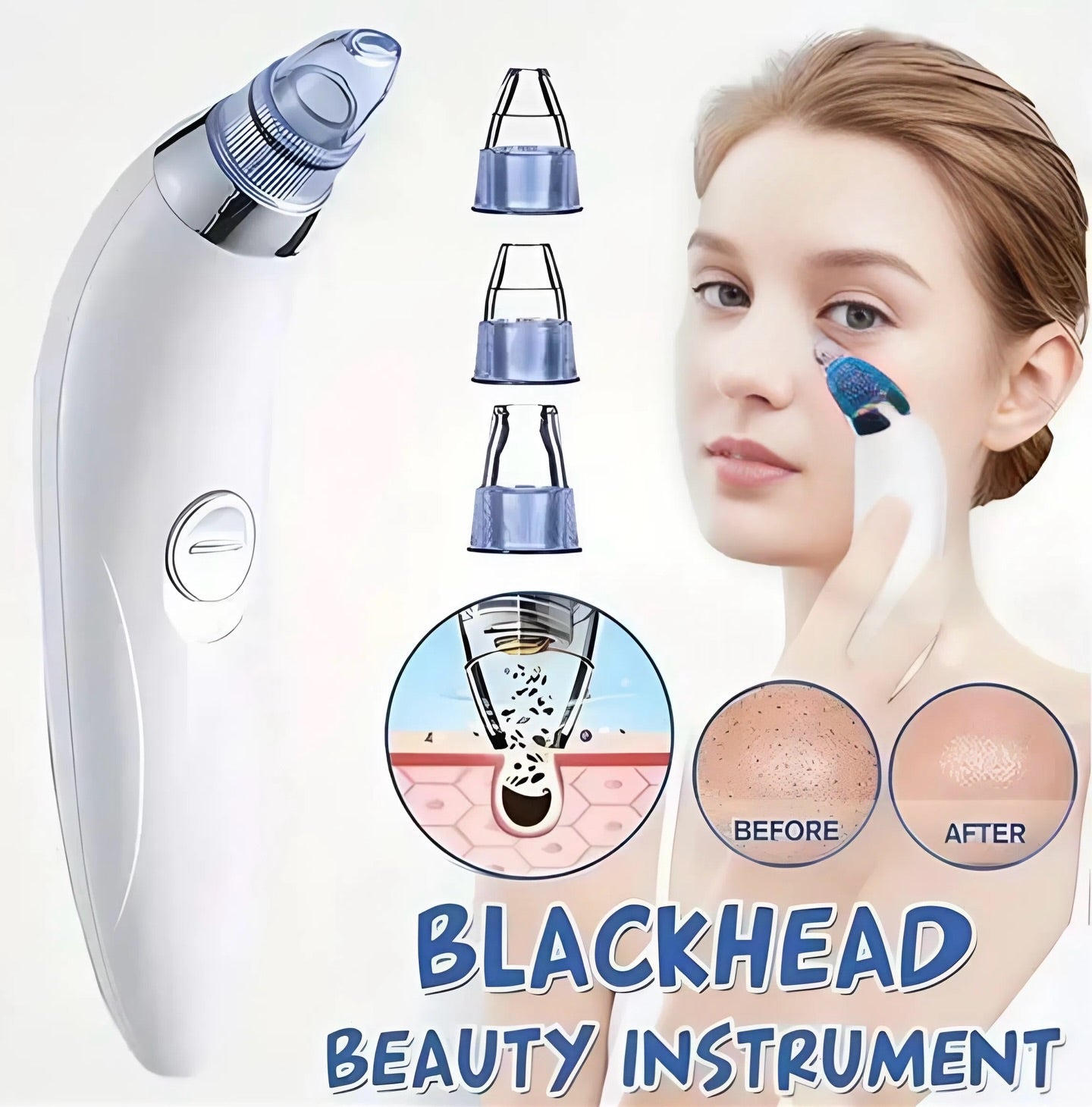 Facial Beauty - 5 in 1 Blackheads Vaccum Derma Suction