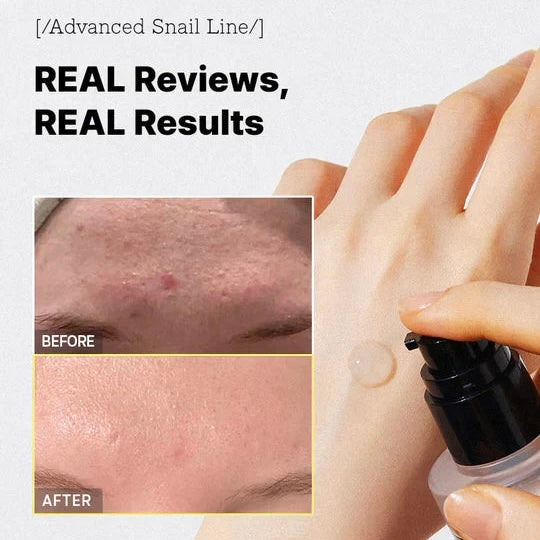 Cosrx - Advanced Snail 96 Mucin Power Essence 100ml