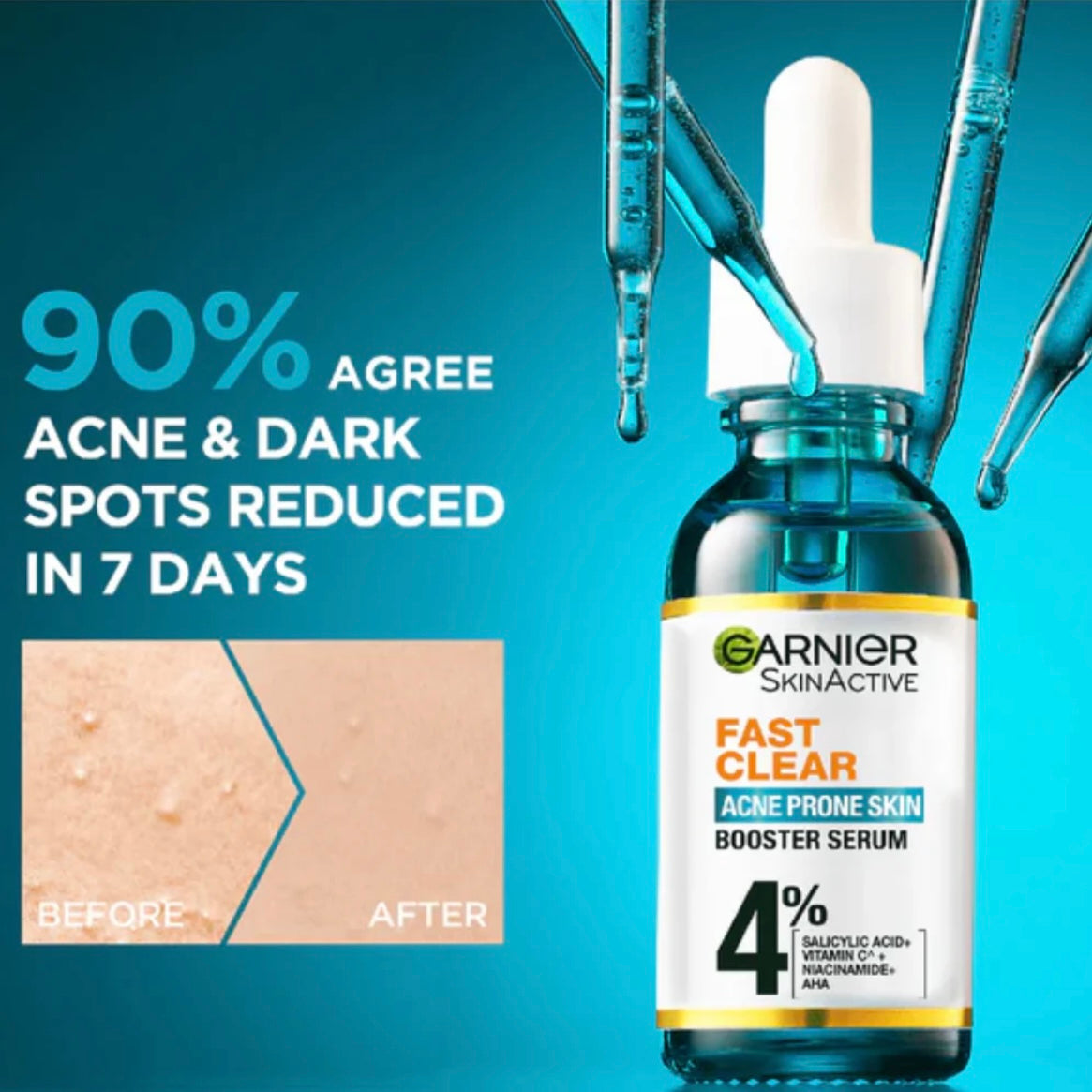 Garnier Fast Clear Acne Prone Skin Booster Serum - 30ml